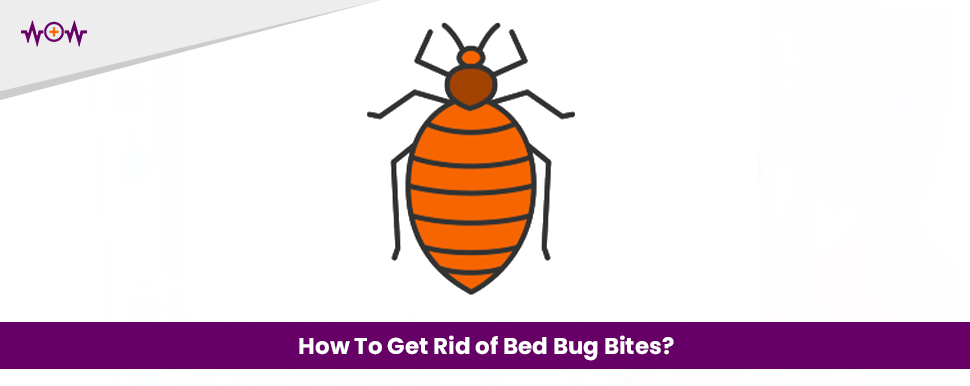 how-to-get-rid-of-bed-bug-bites