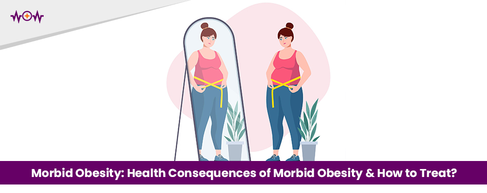 Morbid Obesity: What are the Health Consequences of Morbid Obesity and How to Treat it?