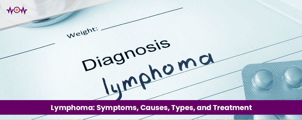lymphoma-symptoms-causes-types-and-treatment