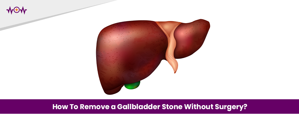 how-to-remove-a-gallbladder-stone-without-surgery