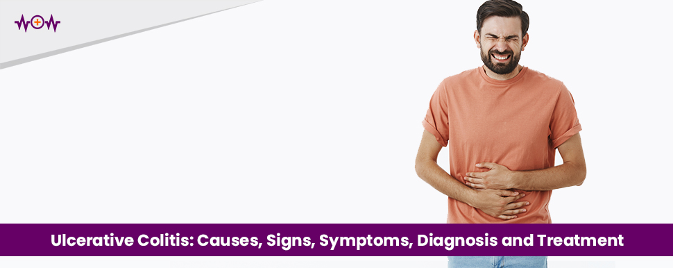 ulcerative-colitis-causes-signs-symptoms-diagnosis-and-treatment