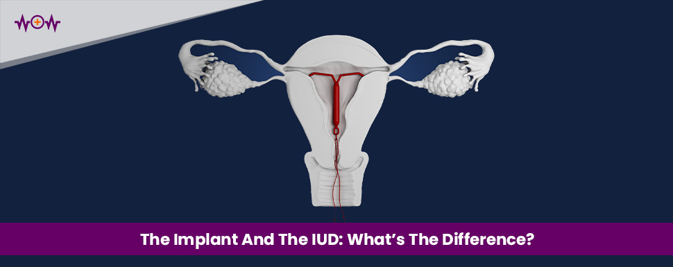The Implant And The IUD: What's The Difference?