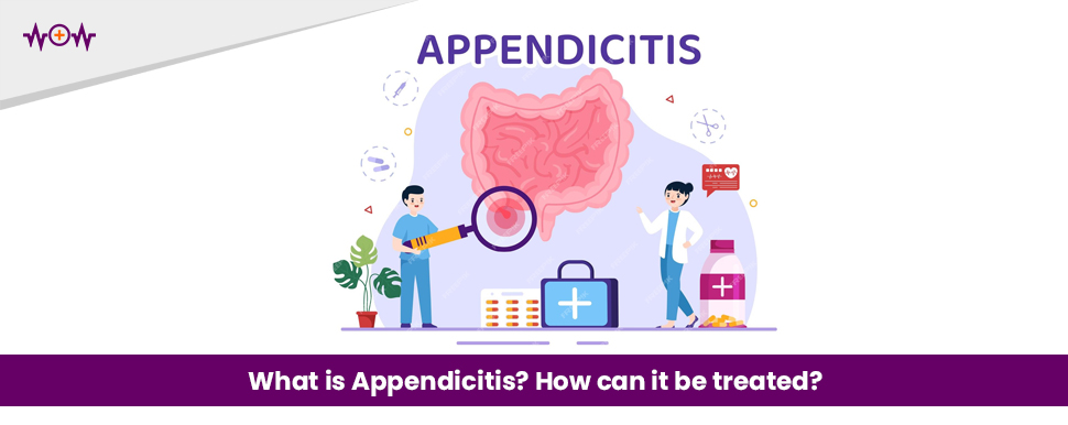 What is Appendicitis? How can it be treated?
