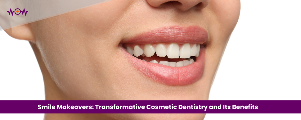 smile-makeovers-transformative-cosmetic-dentistry-and-its-benefits
