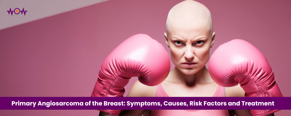 primary-angiosarcoma-of-the-breast-symptoms-causes-risk-factors-and-treatment