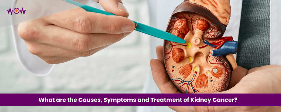 what-are-the-causes-symptoms-and-treatment-of-kidney-cancer