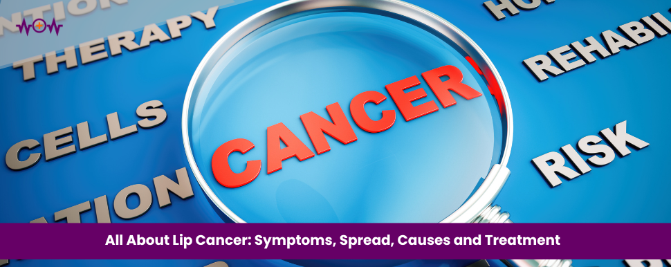 all-about-lip-cancer-symptoms-spread-causes-and-treatment
