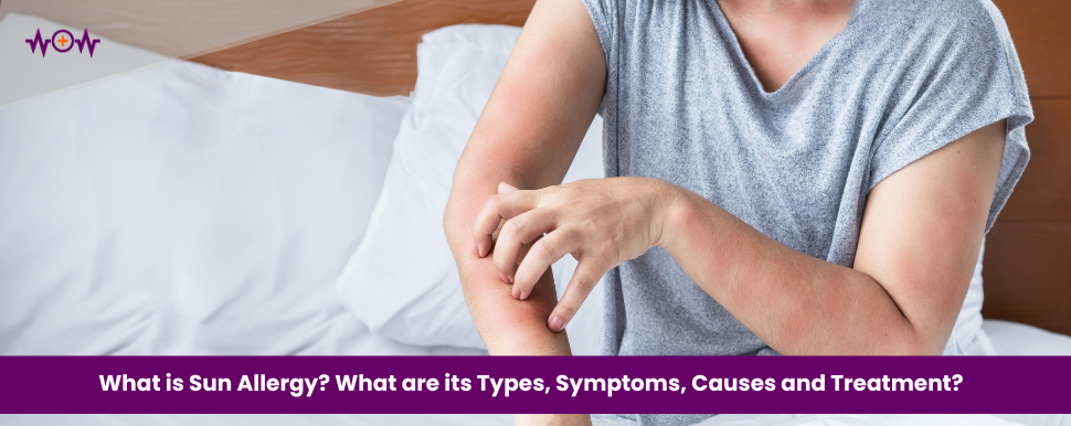 what-is-sun-allergy-what-are-its-types-symptoms-causes-and-treatment