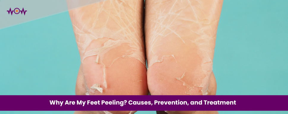 why-are-my-feet-peeling-causes-prevention-and-treatment