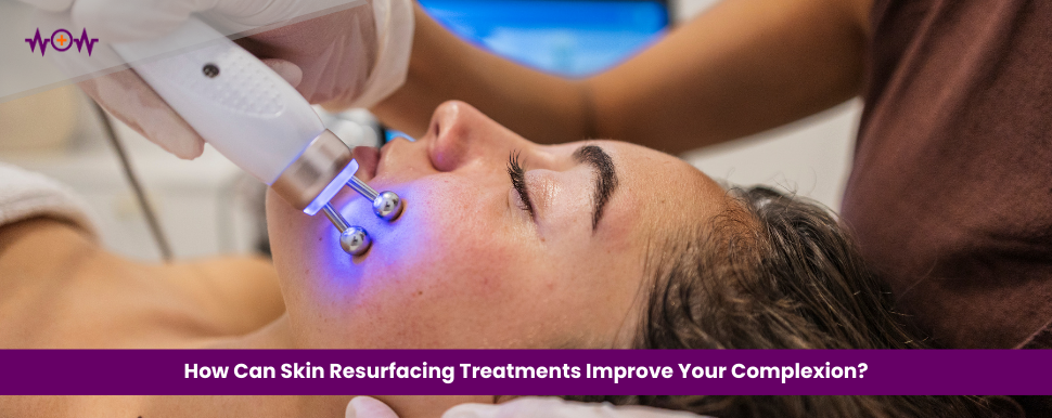how-can-skin-resurfacing-treatments-improve-your-complexion