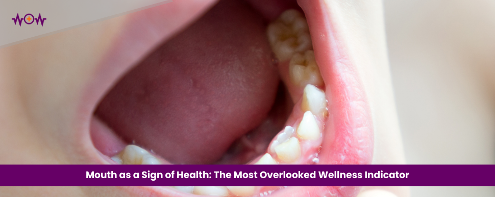 Mouth as a Sign of Health: The Most Overlooked Wellness Indicator