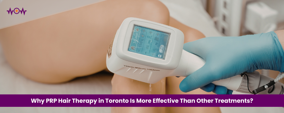 why-prp-hair-therapy-in-toronto-is-more-effective-than-other-treatments