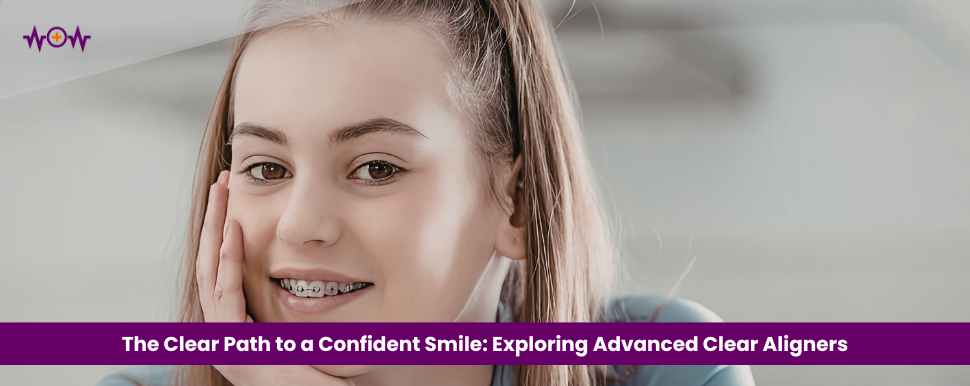 the-clear-path-to-a-confident-smile-exploring-advanced-clear-aligners